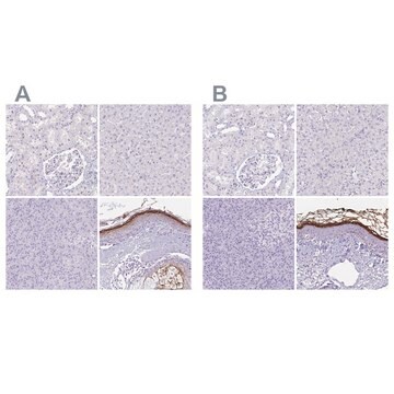 Anti-CDSN antibody produced in rabbit Prestige Antibodies&#174; Powered by Atlas Antibodies, affinity isolated antibody, buffered aqueous glycerol solution