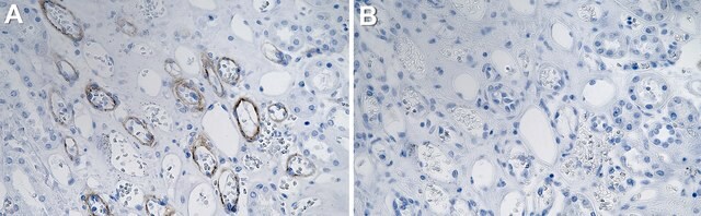 Anti-HSPG2 Antibody, clone 1M17 ZooMAb&#174; Rabbit Monoclonal recombinant, expressed in HEK 293 cells