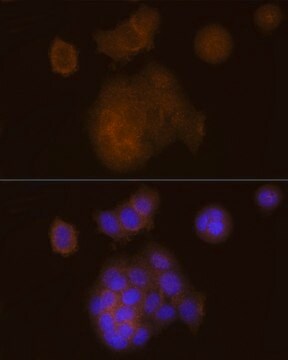 Anti-SOCS1 Antibody, clone 5T6Z10, Rabbit Monoclonal