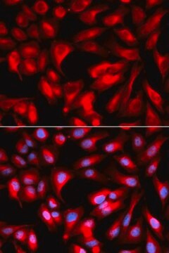 Anti- CD168/RHAMM antibody produced in rabbit