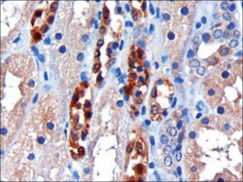 Anti-CBR1 antibody produced in goat affinity isolated antibody, buffered aqueous solution