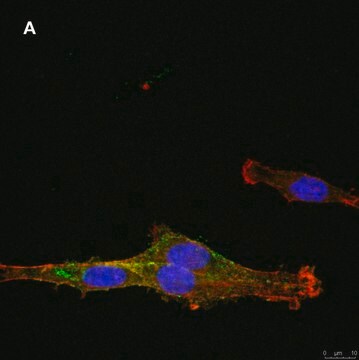 Anti-NG2 Antibody, clone 1L2, ZooMAb&#174; Rabbit Monoclonal recombinant, expressed in HEK 293 cells