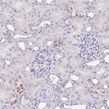 Anti-TAS2R39 antibody produced in rabbit Prestige Antibodies&#174; Powered by Atlas Antibodies, affinity isolated antibody, buffered aqueous glycerol solution