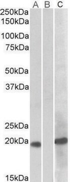 Anti-HOXA1 antibody produced in goat affinity isolated antibody, buffered aqueous solution