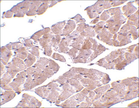 Anti-TRPC3 (ab3) antibody produced in rabbit affinity isolated antibody, buffered aqueous solution