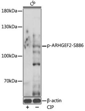 Anti-Phospho-ARHGEF2-S886 antibody produced in rabbit