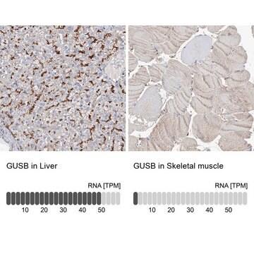 Anti-GUSB antibody produced in rabbit Prestige Antibodies&#174; Powered by Atlas Antibodies, affinity isolated antibody, buffered aqueous glycerol solution