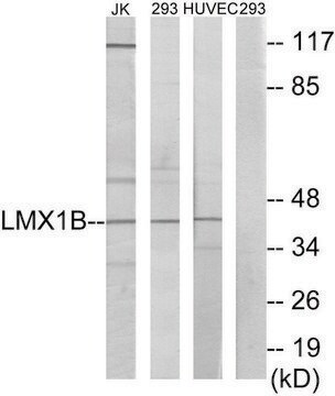 Anti-LMX1B antibody produced in rabbit affinity isolated antibody