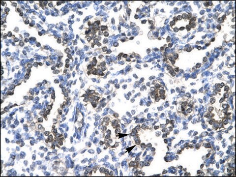 Anti-FOSB antibody produced in rabbit IgG fraction of antiserum