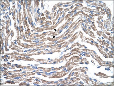 Anti-CLDN11 antibody produced in rabbit affinity isolated antibody