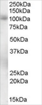 Anti-PDE5A antibody produced in goat affinity isolated antibody, buffered aqueous solution