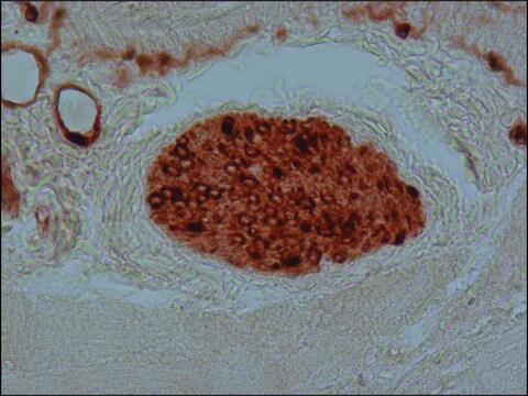 Anti-S-100 (&#946;-Subunit) antibody, Mouse monoclonal clone SH-B1, purified from hybridoma cell culture