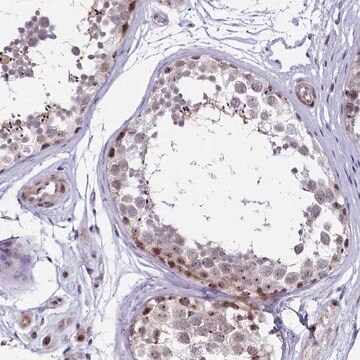 Anti-TCOF1 antibody produced in rabbit Prestige Antibodies&#174; Powered by Atlas Antibodies, affinity isolated antibody, buffered aqueous glycerol solution