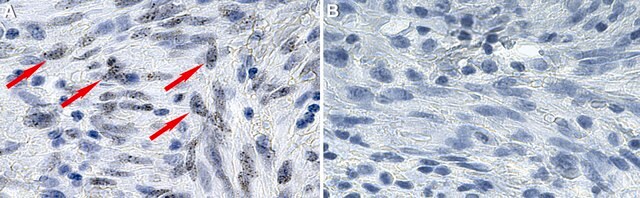 Anti-HHV-8 LNA-1 Antibody, clone LN53 ZooMAb&#174; Rat Monoclonal recombinant, expressed in HEK 293 cells