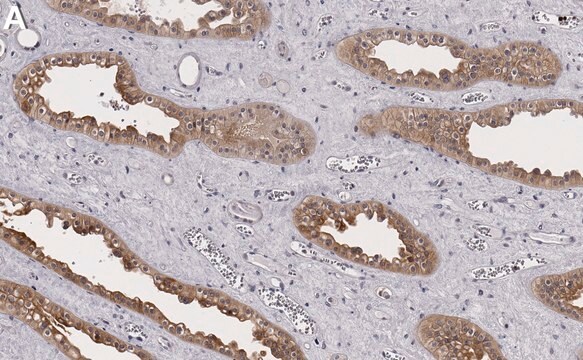 Anti-Pyk2/PTK2B Antibody, clone 3B7 ZooMAb&#174; Rabbit Monoclonal recombinant, expressed in HEK 293 cells