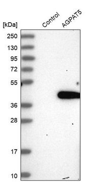 Anti-AGPAT5 antibody produced in rabbit Prestige Antibodies&#174; Powered by Atlas Antibodies, affinity isolated antibody, buffered aqueous glycerol solution