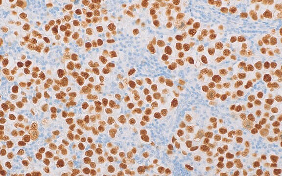 MAGEC2 (EP405) Rabbit Monoclonal Primary Antibody