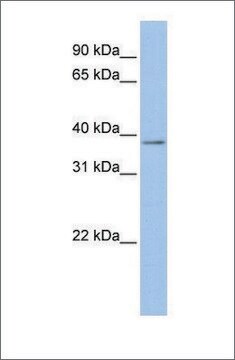 Anti-MSLN antibody produced in rabbit affinity isolated antibody