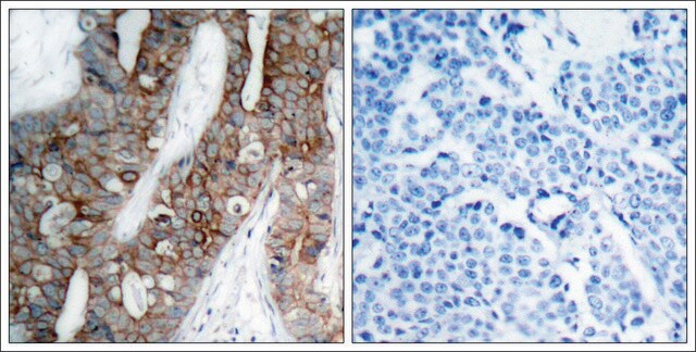 Anti-ITGB3 (Ab-773) antibody produced in rabbit affinity isolated antibody