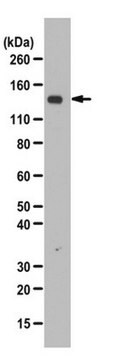 磷酸化USP7（Ser18）抗体 from rabbit, purified by affinity chromatography