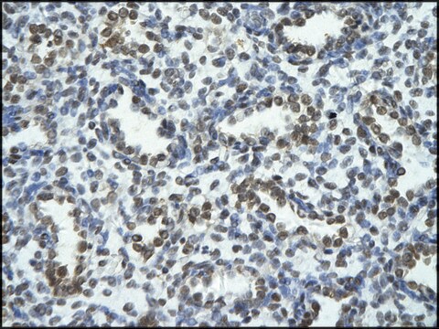 Anti-TRIOBP antibody produced in rabbit affinity isolated antibody