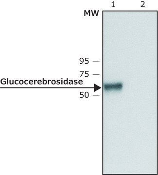 抗 葡萄糖脑苷脂酶（C 端） 兔抗 ~1&#160;mg/mL, affinity isolated antibody, buffered aqueous solution