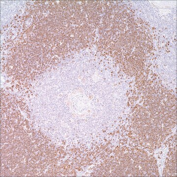 TdT Rabbit Polyclonal Antibody