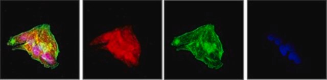 Przeciwciało anty-PCSK9 from rabbit, purified by affinity chromatography