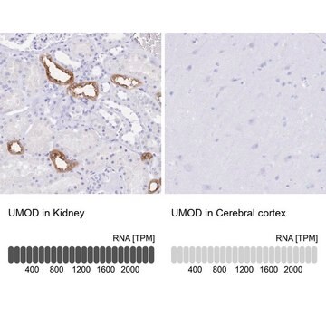 Anti-UMOD antibody produced in rabbit Prestige Antibodies&#174; Powered by Atlas Antibodies, affinity isolated antibody, buffered aqueous glycerol solution