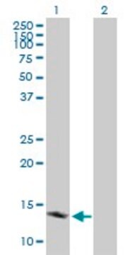 Anti-TSPO antibody produced in mouse purified immunoglobulin, buffered aqueous solution