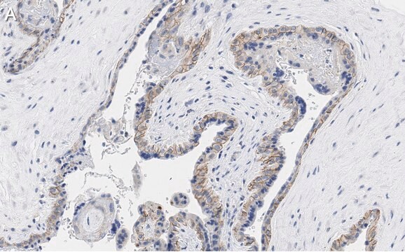 抗PD-L1/CD274抗体 クローン3O12 ZooMAb&#174;ウサギモノクローナル recombinant, expressed in HEK 293 cells