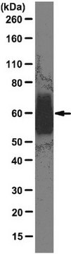 Anticorpo anti-trasportatore degli amminoacidi eccitatori 2, clone G6 clone G6, from mouse