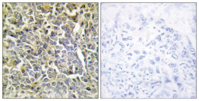 Anti-Collagen VI &#945;2 antibody produced in rabbit affinity isolated antibody