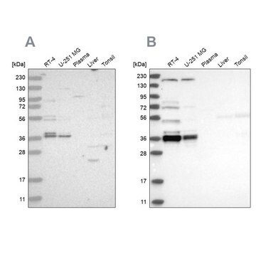 Anti-C1orf131 antibody produced in rabbit Prestige Antibodies&#174; Powered by Atlas Antibodies, affinity isolated antibody, buffered aqueous glycerol solution, ab1