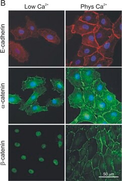 Anti-&#945;-Catenin antibody produced in rabbit whole antiserum