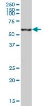 Anti-CES2 antibody produced in mouse purified immunoglobulin, buffered aqueous solution