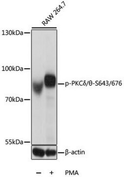 Anti-Phospho-PKC&#948;/&#952;-S643/676 antibody produced in rabbit