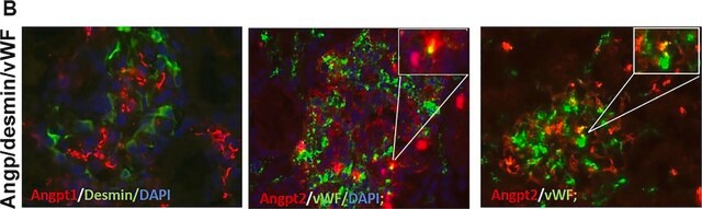 Anti-Desmin Antibody, clone DE-B-5 clone DE-B-5, Chemicon&#174;, from mouse