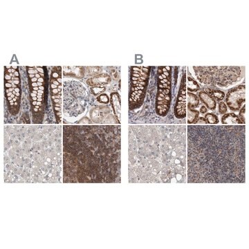 Anti-DARS2 antibody produced in rabbit Prestige Antibodies&#174; Powered by Atlas Antibodies, affinity isolated antibody, buffered aqueous glycerol solution, Ab2