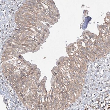 Anti-XRN1 antibody produced in rabbit Prestige Antibodies&#174; Powered by Atlas Antibodies, affinity isolated antibody, buffered aqueous glycerol solution