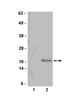 Anti-p19 ARF Antibody Upstate&#174;, from rabbit