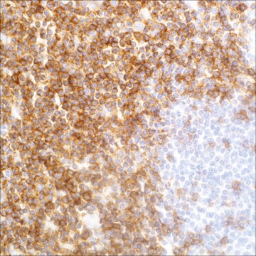 CD5 (EP77) Rabbit Monoclonal Primary Antibody