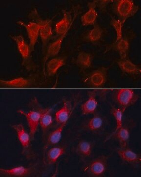 Anti-VEGF antibody produced in rabbit