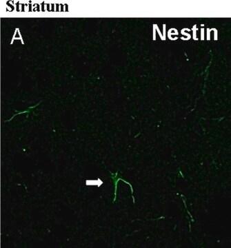 Anticuerpo anti-nestina, clon rata-401 clone rat-401, Chemicon&#174;, from mouse