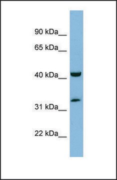 Anti-RAGE, (N-terminal) antibody produced in rabbit affinity isolated antibody