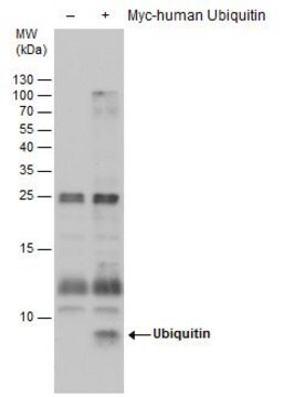 モノクローナル抗ユビキチン抗体 マウス宿主抗体 clone GT751, affinity isolated antibody