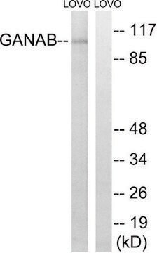 Anti-GANAB antibody produced in rabbit affinity isolated antibody