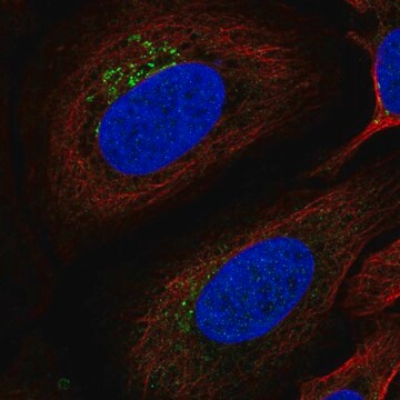 Anti-ITM2B antibody produced in rabbit Prestige Antibodies&#174; Powered by Atlas Antibodies, affinity isolated antibody