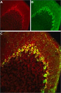 Anti-Anti-Calcium Channel CaV3.2 (&#945;1H) affinity isolated antibody, lyophilized powder