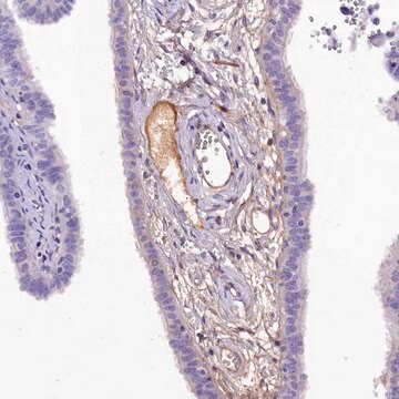 Anti-SOD3 antibody produced in rabbit Prestige Antibodies&#174; Powered by Atlas Antibodies, affinity isolated antibody, buffered aqueous glycerol solution